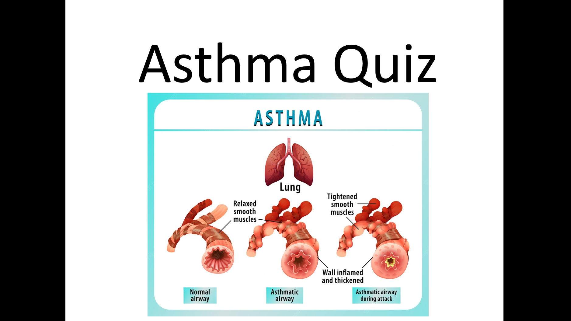 You are currently viewing Asthma Quiz