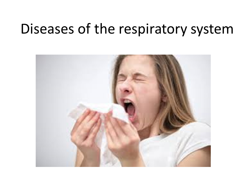 You are currently viewing Disease Of Respiratory System