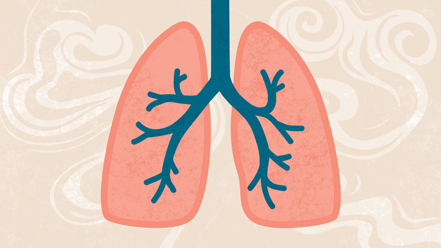 You are currently viewing Chronic Obstructive Pulmonary Disease (COPD) Quiz