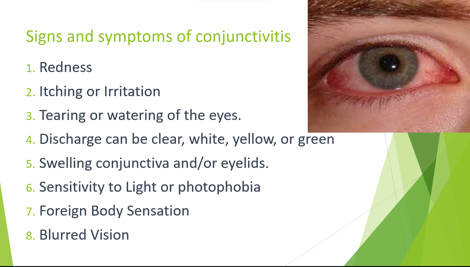 Conjuntivitis Signs, symptoms and treatment - Ms.Thu Medical English